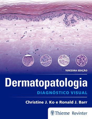 Imagem de Livro - Dermatopatologia