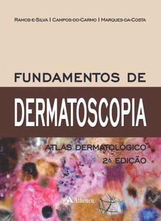 Imagem de Livro - Fundamentos de Dermatoscopia