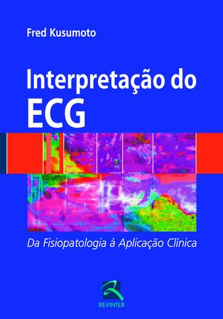 Imagem de Livro - Interpretação do ECG