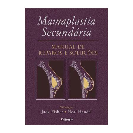Imagem de Livro - Mamaplastia Secundária, Manual de Reparos e Soluções - Fisher - DiLivros