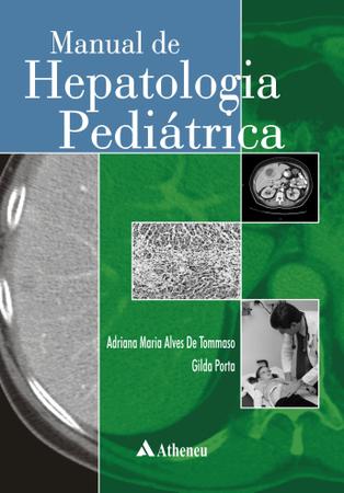 Imagem de Livro - Manual de hepatologia pediátrica