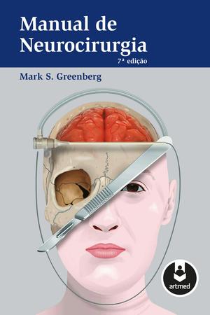 Imagem de Livro - Manual de Neurocirurgia