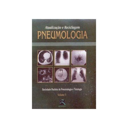 Imagem de Livro - Pneumologia