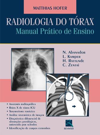 Imagem de Livro - Radiologia do Tórax