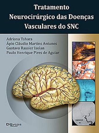 Imagem de Livro - Tratamento Neurocirúrgico das Doenças Vasculares do SNC - Tahara - DiLivros