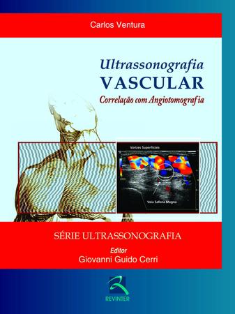 Imagem de Livro - Ultrassonografia Vascular