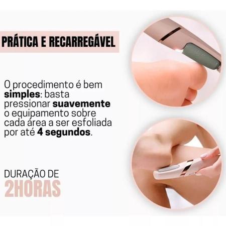 Imagem de Lixadora Para Pés Elétrico Lixador e Removedor de Calo Portátil USB Raspador de Pés 2 Potências Recarregável Bivolt