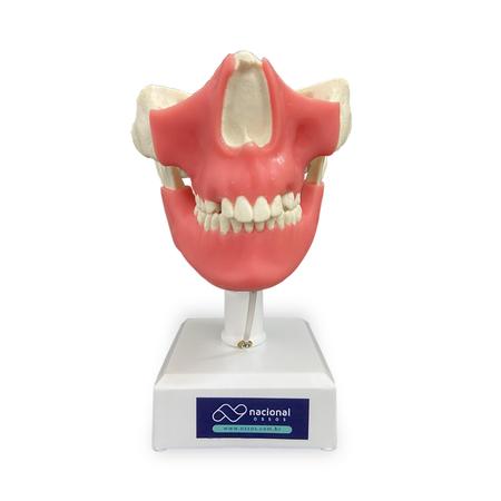 Imagem de Manequim odontológico com Dentes Terceiro Molares e Caninos Inclusos e Gengiva Nacional Ossos