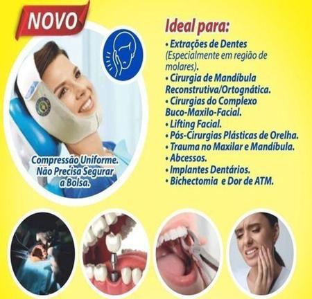 Cirurgia de mandíbula e maxilar - Consulta Ideal