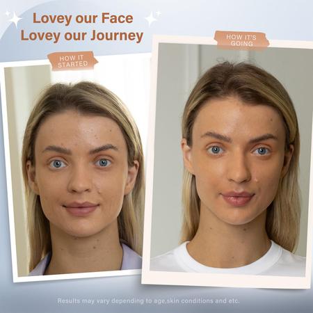 Máscara facial LED NEWKEY Wireless Silicone Red Light Therapy Imagem de Máscara facial LED NEWKEY Wireless Silicone Red Light Therapy