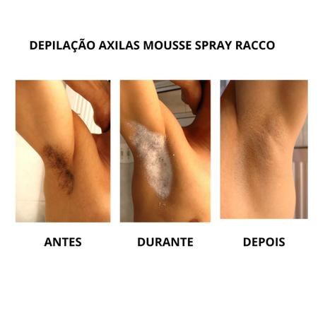 Imagem de  Mousse Spray Depilatório  Racco 150 Ml 4 Un