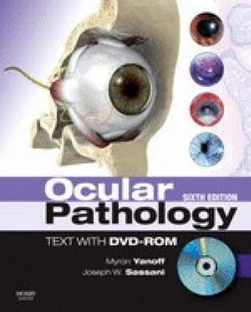 Imagem de Ocular pathology: text with dvd-rom - ELSEVIER ED