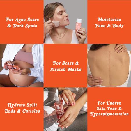 Óleo corporal Bio-Oil para cuidados com a pele para cicatrizes e estrias 125 ml Imagem de Óleo corporal Bio-Oil para cuidados com a pele para cicatrizes e estrias 125 ml