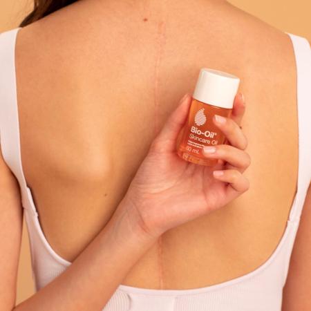 Imagem de Óleo corporal Bio-Oil para cuidados com a pele para cicatrizes e estrias 125 ml