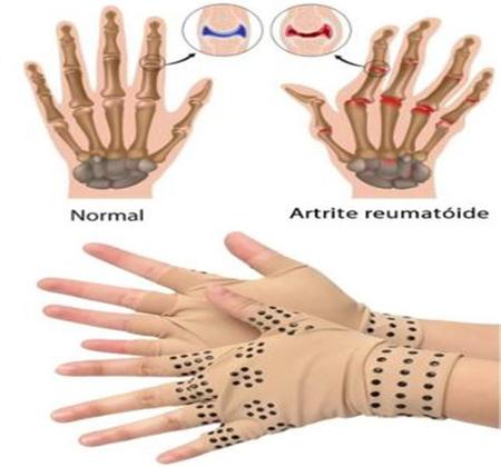 Imagem de Par Lavável Anti Artrite Dedo Luvas Compressão Apoio Mãos