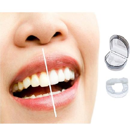 Imagem de Placa Olcusal Bruxismo Ronco Clarear dentes Espertes Molda em Usuário de Aparelho 5em1