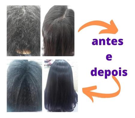 Escova Progressiva 1L Blindagem Líquida Hidratante & Emoliente - Lows Hair  - Progressiva para Cabelo - Magazine Luiza