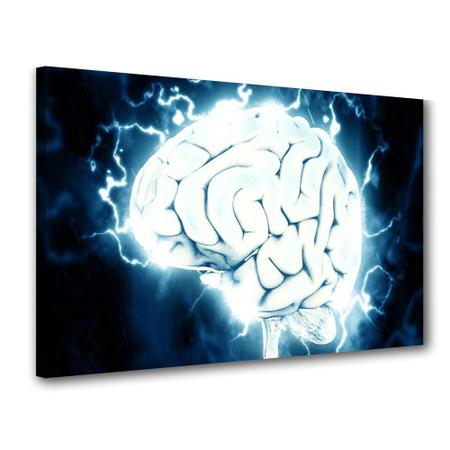 Quadro p62 best sale