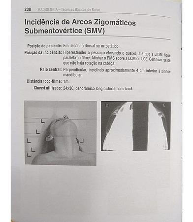 Imagem de Radiologia Técnicas Básicas de Bolso + Caneta Osso - Edição 2023 - EDITORA CORPUS