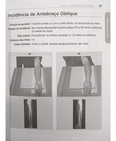 Imagem de Radiologia Técnicas Básicas de Bolso + Caneta Osso - Edição 2023 - EDITORA CORPUS
