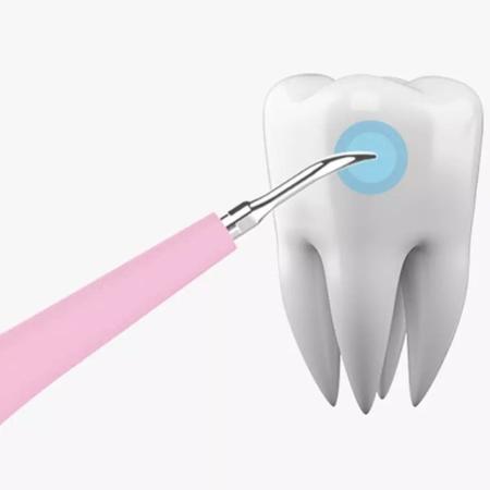 Imagem de Removedor De Tártaro Cálculo Dental Elétrico Raspador