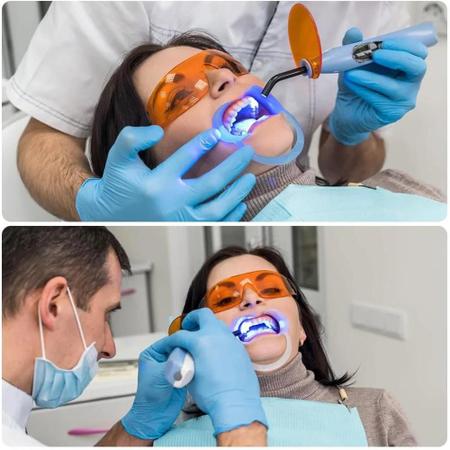 Imagem de Retrator De Bochecha Dental Azul Claro, 10 Peças, Clareamento Dental, Abridor De Lábios Intraoral,