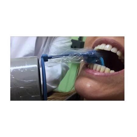 Imagem de Revelador e Fixador Dental Filme Radiografico 475ML Lysanda