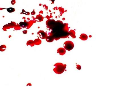 Imagem de Sangue líquido teatral cenográfico realista maquiagem- 500ml