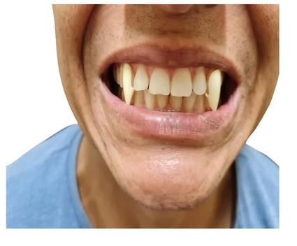 59 ideias de Dente em 2023  dentes de vampiro, vampiro, dentes