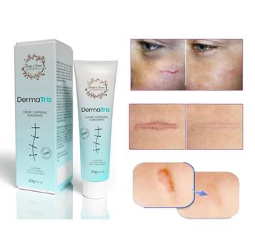 Pomada Creme Para Tratamento Clareador Cicatriz 20g DermaTriz. - Tiarga ...