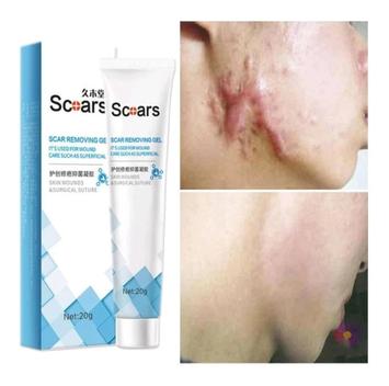 Pomada Gel Creme Para Cicatrizes 20g Scoar - Scoars - Antiestrias ...