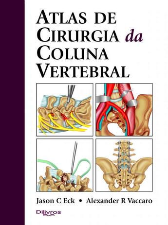 Atlas De Cirurgia Da Coluna Vertebral - Di livros Menor preço em Atlas De Cirurgia Da Coluna Vertebral - Di livros