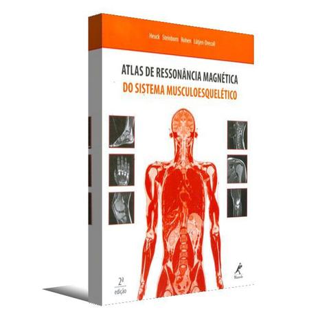 Atlas de ressonância magnética do sistema musculoesquelético Menor preço em Atlas de ressonância magnética do sistema musculoesquelético