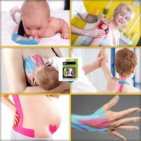 Bandagem Elástica Funcional Fita Kinesio Tape 5M Neuromuscular - Mbfit Menor preço em Bandagem Elástica Funcional Fita Kinesio Tape 5M Neuromuscular - Mbfit