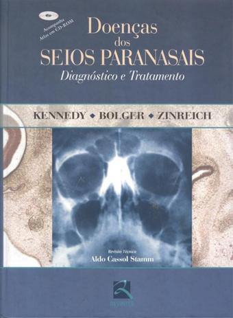 Doencas dos seios paranasais - diagnostico e tratamento - Thieme revinter Menor preço em Doencas dos seios paranasais - diagnostico e tratamento - Thieme revinter
