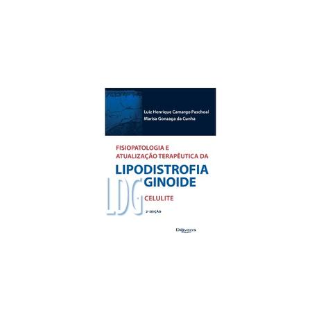Fisiopatologia E Atualização Terapêutica Da Lipodistrofia Ginoide - LDG Celulite - Di livros Menor preço em Fisiopatologia E Atualização Terapêutica Da Lipodistrofia Ginoide - LDG Celulite - Di livros