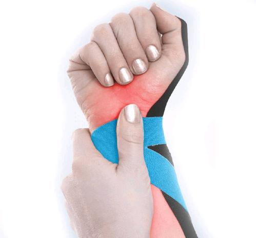 Fita Kinesio Muscle Fix 5x25cm Pre Cortada azul em I Multilaser HC138 é boa?