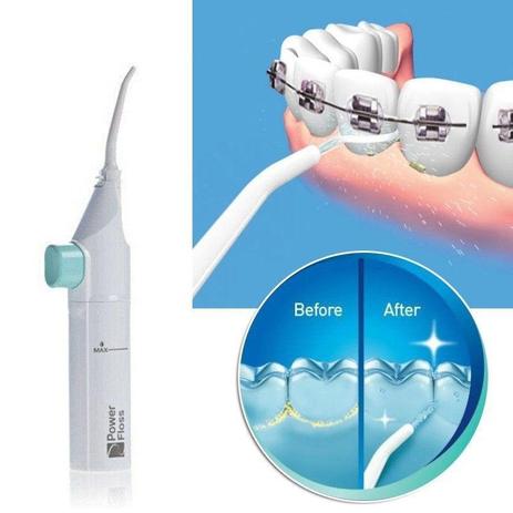 Irrigador Oral Power Floss Limpeza Profunda De Dente E Aparelho - Ultravendas Menor preço em Irrigador Oral Power Floss Limpeza Profunda De Dente E Aparelho - Ultravendas