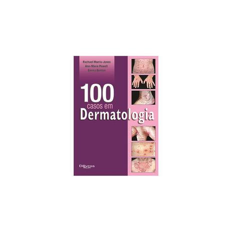 Livro - 100 Casos em Dermatologia - Jones - Dilivros Menor preço em Livro - 100 Casos em Dermatologia - Jones - Dilivros