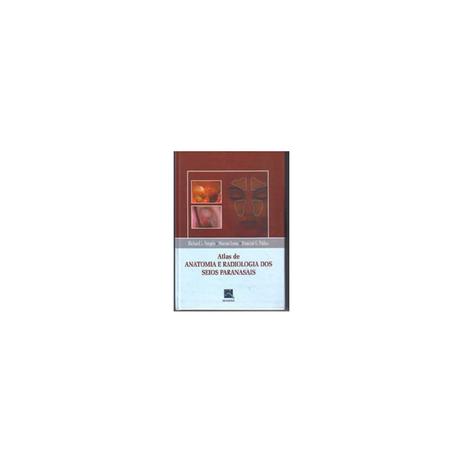 Livro - Atlas de Anatomia e Radiologia dos Seios Paranasais - Voegels - Revinter Menor preço em Livro - Atlas de Anatomia e Radiologia dos Seios Paranasais - Voegels - Revinter