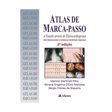 Livro - Atlas de Marca-Passo - A Função Através do Eletrocardiograma - Martinelli Filho - Atheneu Menor preço em Livro - Atlas de Marca-Passo - A Função Através do Eletrocardiograma - Martinelli Filho - Atheneu