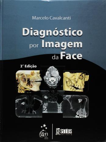 Livro - Diagnóstico por Imagem da Face Menor preço em Livro - Diagnóstico por Imagem da Face