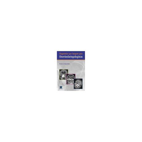 Livro - Diagnóstico por Imagem para Otorrinolaringologistas - Dunnebier - Revinter Menor preço em Livro - Diagnóstico por Imagem para Otorrinolaringologistas - Dunnebier - Revinter
