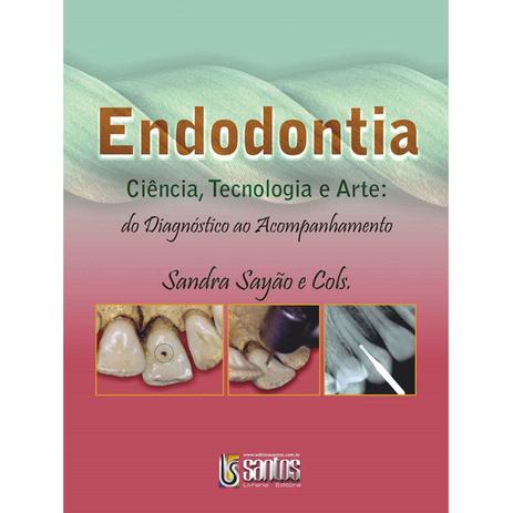 Livro - Endodontia Ciência, Tecnologia e Arte - do diagnóstico ao acompanhamento - Sayão - Santos Menor preço em Livro - Endodontia Ciência, Tecnologia e Arte - do diagnóstico ao acompanhamento - Sayão - Santos