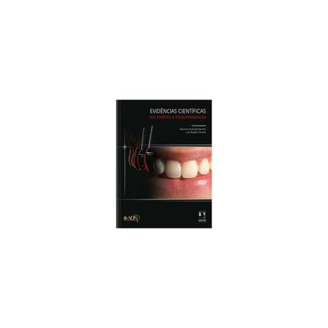 Livro - Evidências Científicas em Estética e Osseointegração - Duarte - Napoleão Menor preço em Livro - Evidências Científicas em Estética e Osseointegração - Duarte - Napoleão