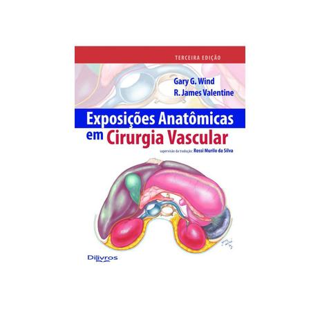 Livro - Exposições Anatômicas em Cirurgia Vascular - Wind - Dilivros Menor preço em Livro - Exposições Anatômicas em Cirurgia Vascular - Wind - Dilivros