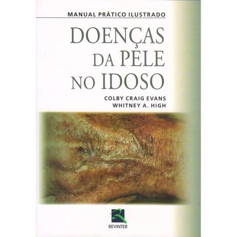 Livro - Manual Prático Ilustrado Doenças da Pele no Idoso - Evans - Revinter Menor preço em Livro - Manual Prático Ilustrado Doenças da Pele no Idoso - Evans - Revinter