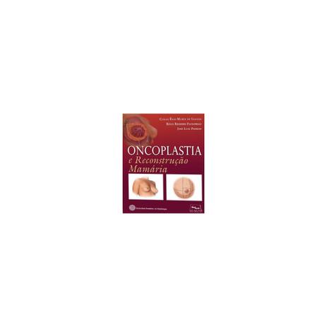 Livro - Oncoplastia - Oncologia e Reconstrução Mamária -SBM - Lucena - Medbook Menor preço em Livro - Oncoplastia - Oncologia e Reconstrução Mamária -SBM - Lucena - Medbook