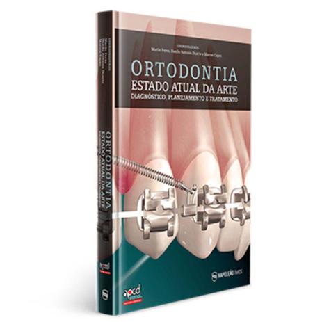 Livro Ortodontia Estado Atual da Arte - Diagnóstico, Planejamento e Tratamento - Napoleão Menor preço em Livro Ortodontia Estado Atual da Arte - Diagnóstico, Planejamento e Tratamento - Napoleão