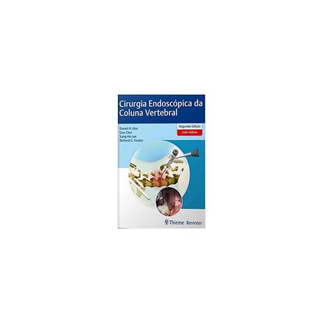 Livro - Procedimentos Endoscópicos da Coluna Vertebral - Kim - Dilivros Menor preço em Livro - Procedimentos Endoscópicos da Coluna Vertebral - Kim - Dilivros